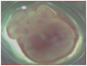3D ex vivo imaging  - Whole tissue imaging - mouse ovary - Given its tremendous use in clinical settings, SCREEN has adapted this technique in 3D ex vivo applications for detailed imaging of spheroids/ organoids and large tissues.