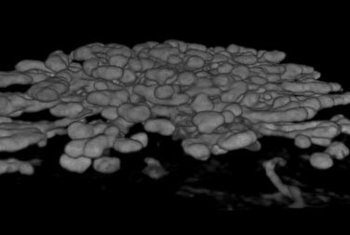 3D ex vivo imaging  - Whole tissue imaging - mouse ovary - Given its tremendous use in clinical settings, SCREEN has adapted this technique in 3D ex vivo applications for detailed imaging of spheroids/ organoids and large tissues. kidney 3D trimming view